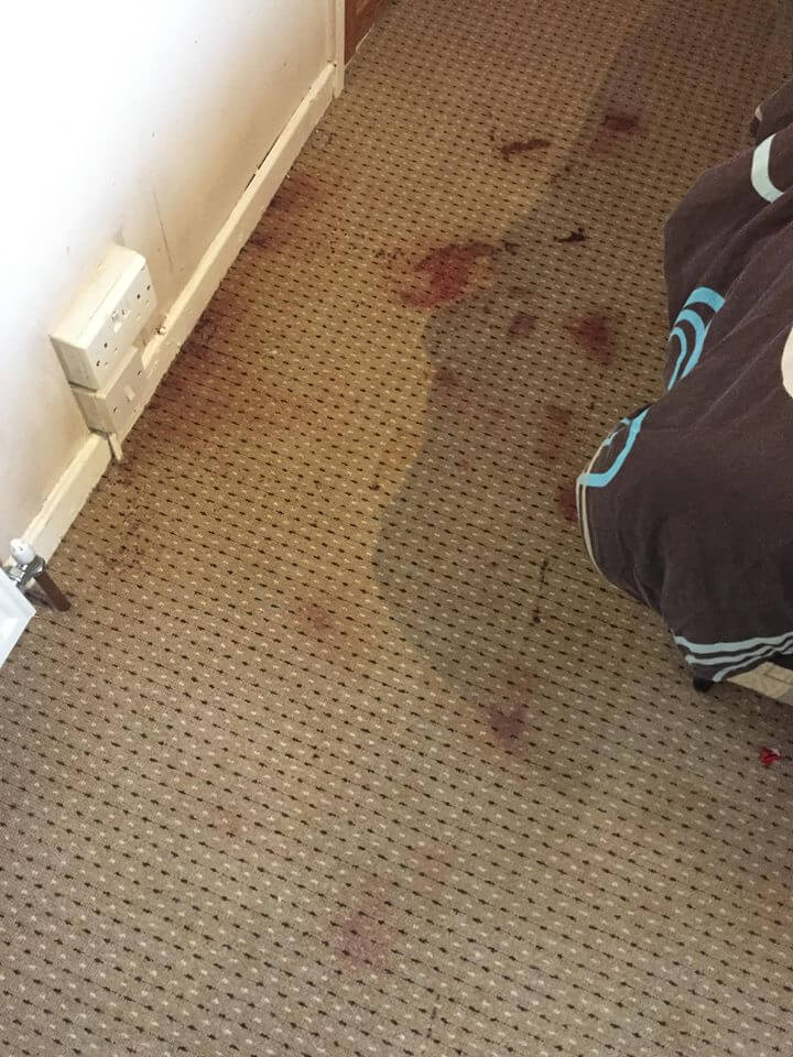 Cleaning up blood on your carpet